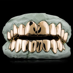 Yellow Gold Grillz (NPG) (Custom)
