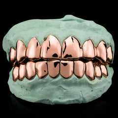 Rose Gold Grillz (NPG) (Custom)