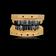 Black Rhodium Grillz (Custom)