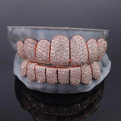 Rose Gold Moissanite Grillz 14k (NPG) (Custom)