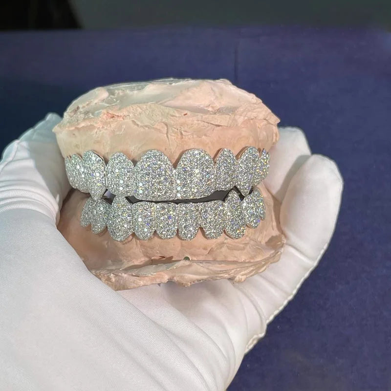 White Gold Moissanite Grillz 14k (NPG) (Custom)